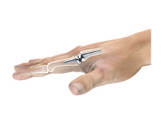 Artificial Finger Joint Replacement